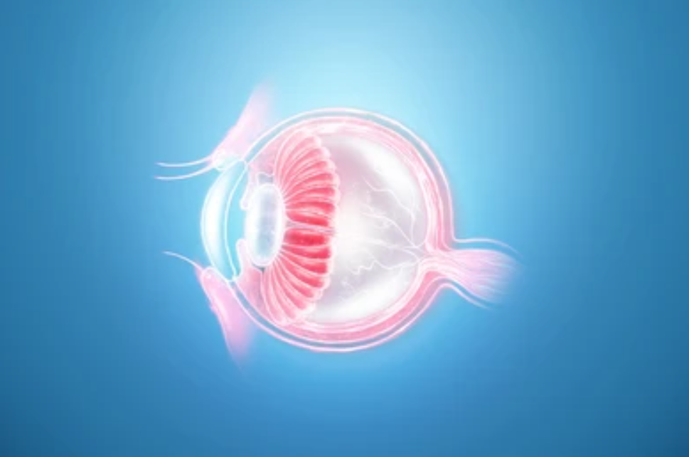 What is a Cataract?