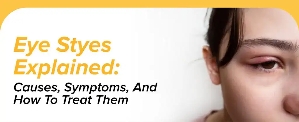 Eye Stye(Sty) Explained: Causes, Symptoms, And How To Treat Them