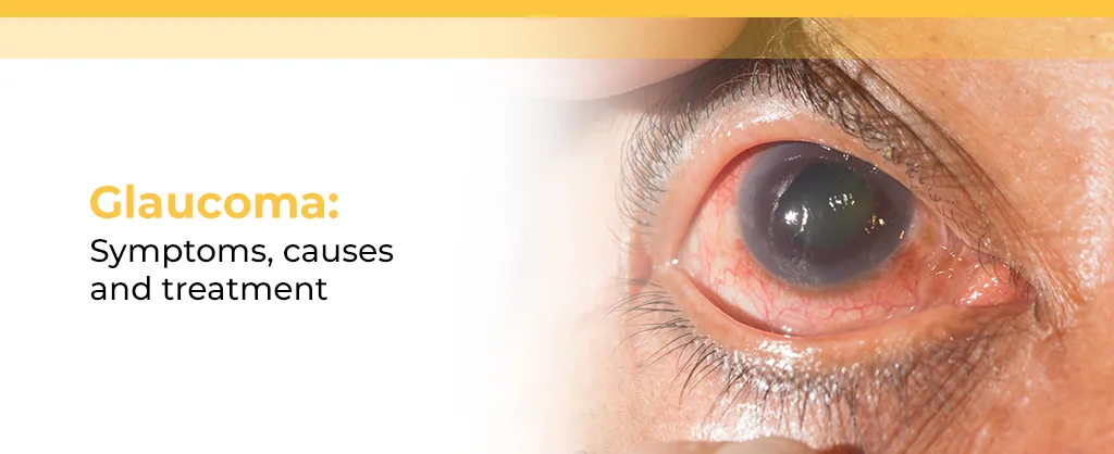 Glaucoma: Symptoms, causes and treatment