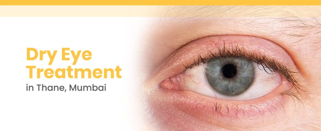 Dry Eye Treatment in Thane, Mumbai