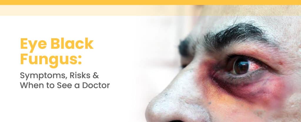 Eye Black Fungus: Symptoms, Risks & When to See a Doctor