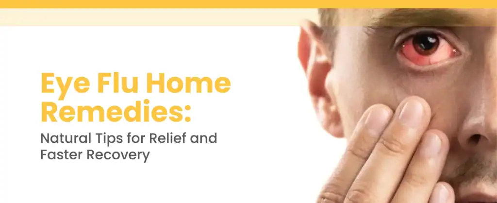 Eye Flu Home Remedies: Natural Tips for Relief and Faster Recovery