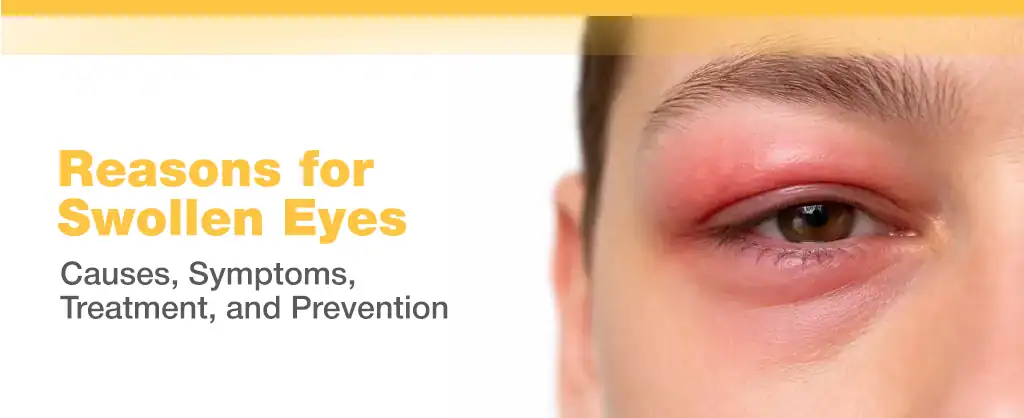 Reasons for Swollen Eyes: Causes, Symptoms, Treatment, and Prevention