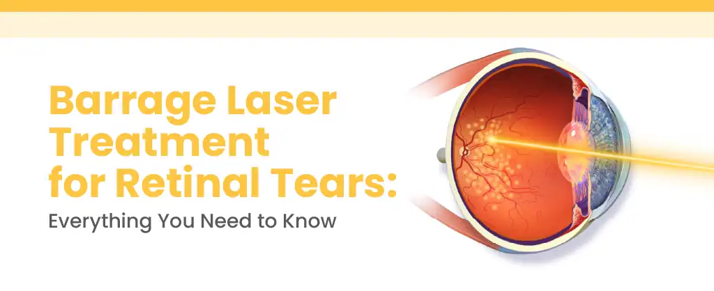 Barrage Laser Treatment for Retinal Tears: Everything You Need to Know